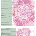 Chronic Obstructive Pulmonary Disease