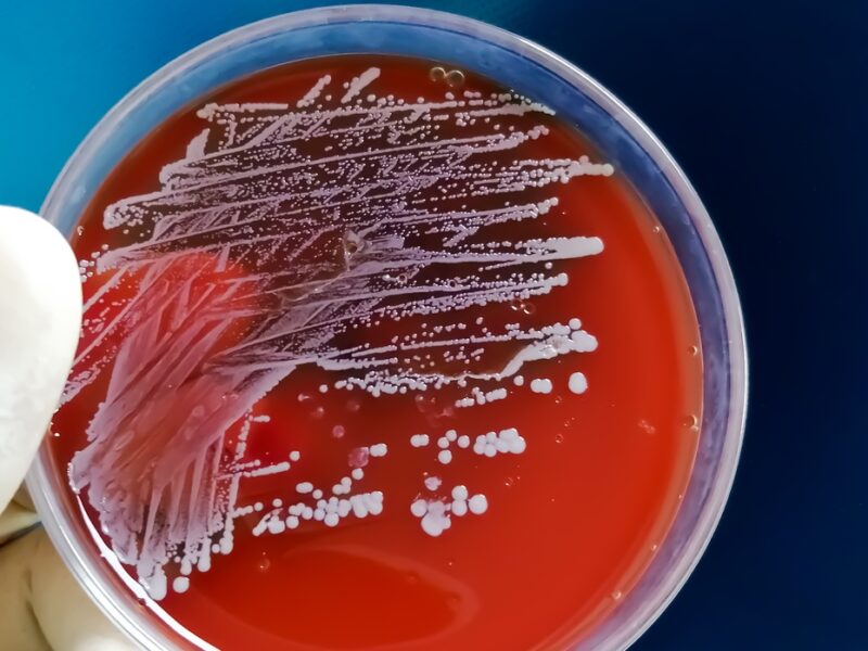 Microbiologia Fibrosi Cistica: Approcci e Campionamento