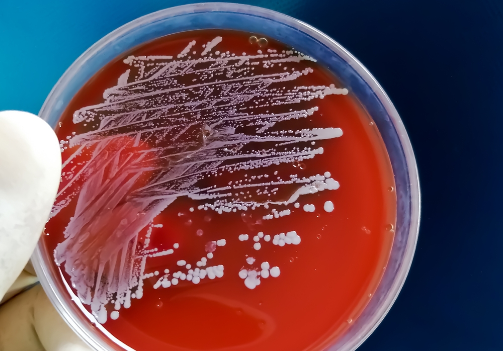 Microbiologia Fibrosi Cistica: Approcci e Campionamento