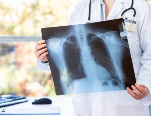 le infezioni polmonari associate alla Fibrosi Cistica