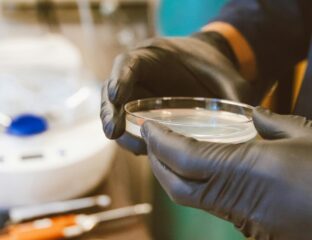 infezioni del sistema nervoso centrale